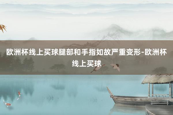 欧洲杯线上买球腿部和手指如故严重变形-欧洲杯线上买球